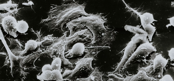 Symbolbild für entartete Krebszelle